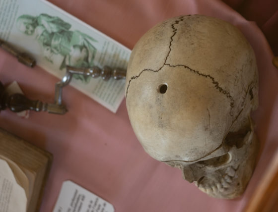 Hautefort Dordogne France Medicine History Medieval Hôtel-Dieu Dentist Plague Chateau Castle